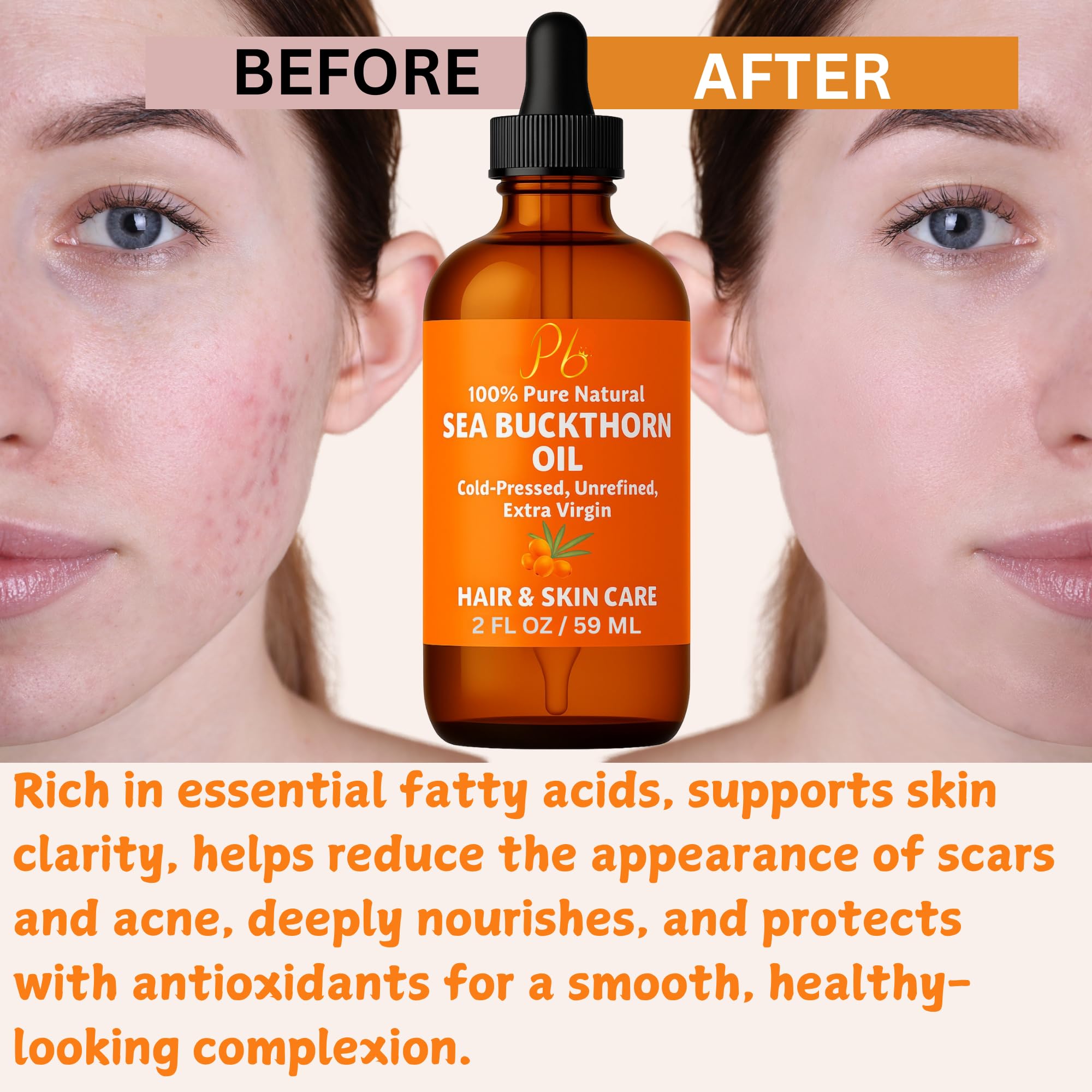 Pomberries Sea Buckthorn Oil scalp relief with moisture balance