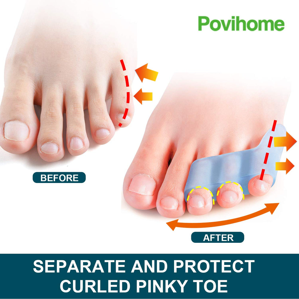 Povihome pinky toe protection soft silicone for daily toe comfort.