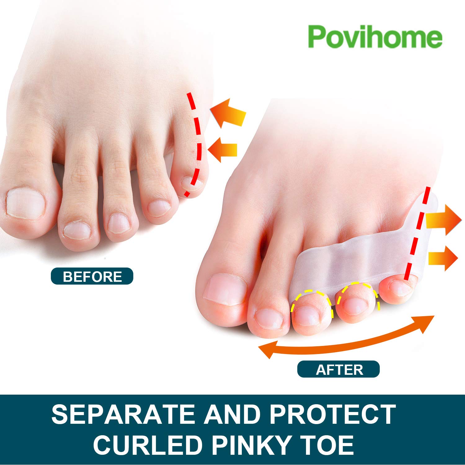 Povihome pinky toe protectors in soft silicone protect against toe chafing