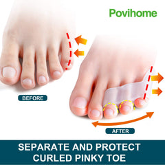 Povihome pinky toe protectors in soft silicone protect against toe chafing