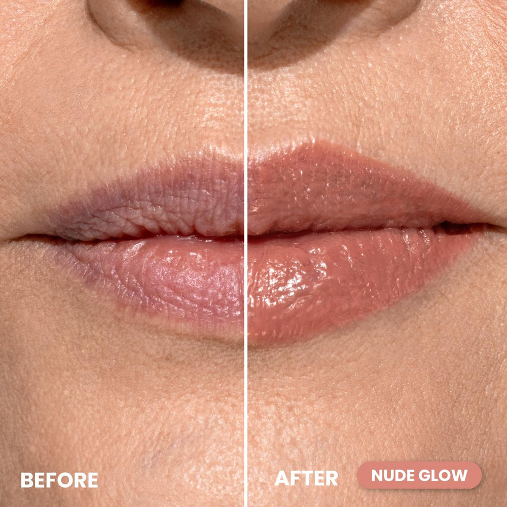 PrimePrometics PrimeLip with twist cap for precise, easy lip shaping.