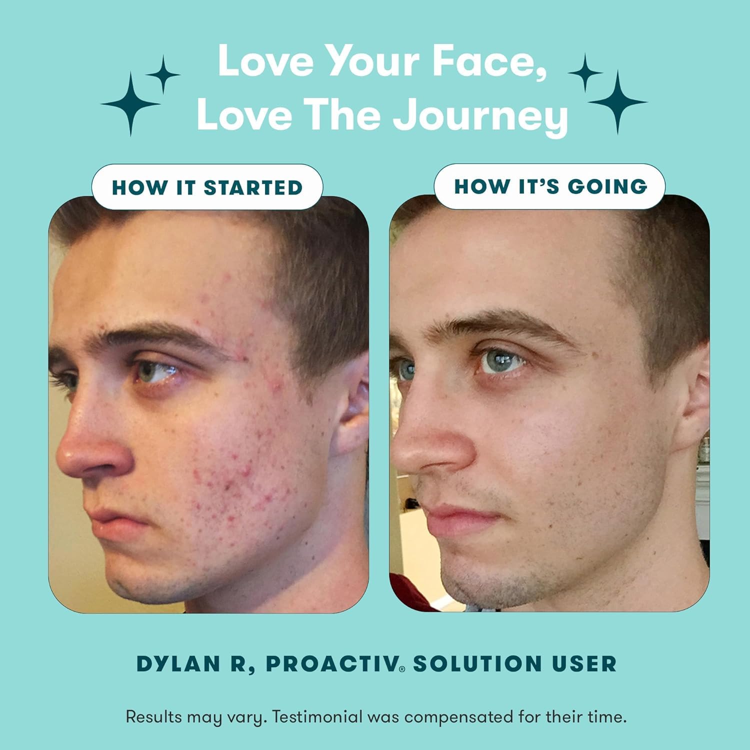 Proactiv 90-day kit packaging provides ongoing acne care solution