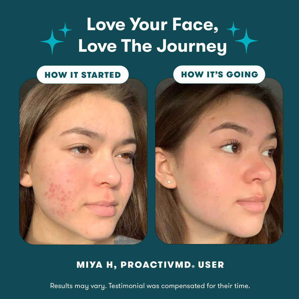 Proactiv MD 30-day acne kit box brings three-step routine.