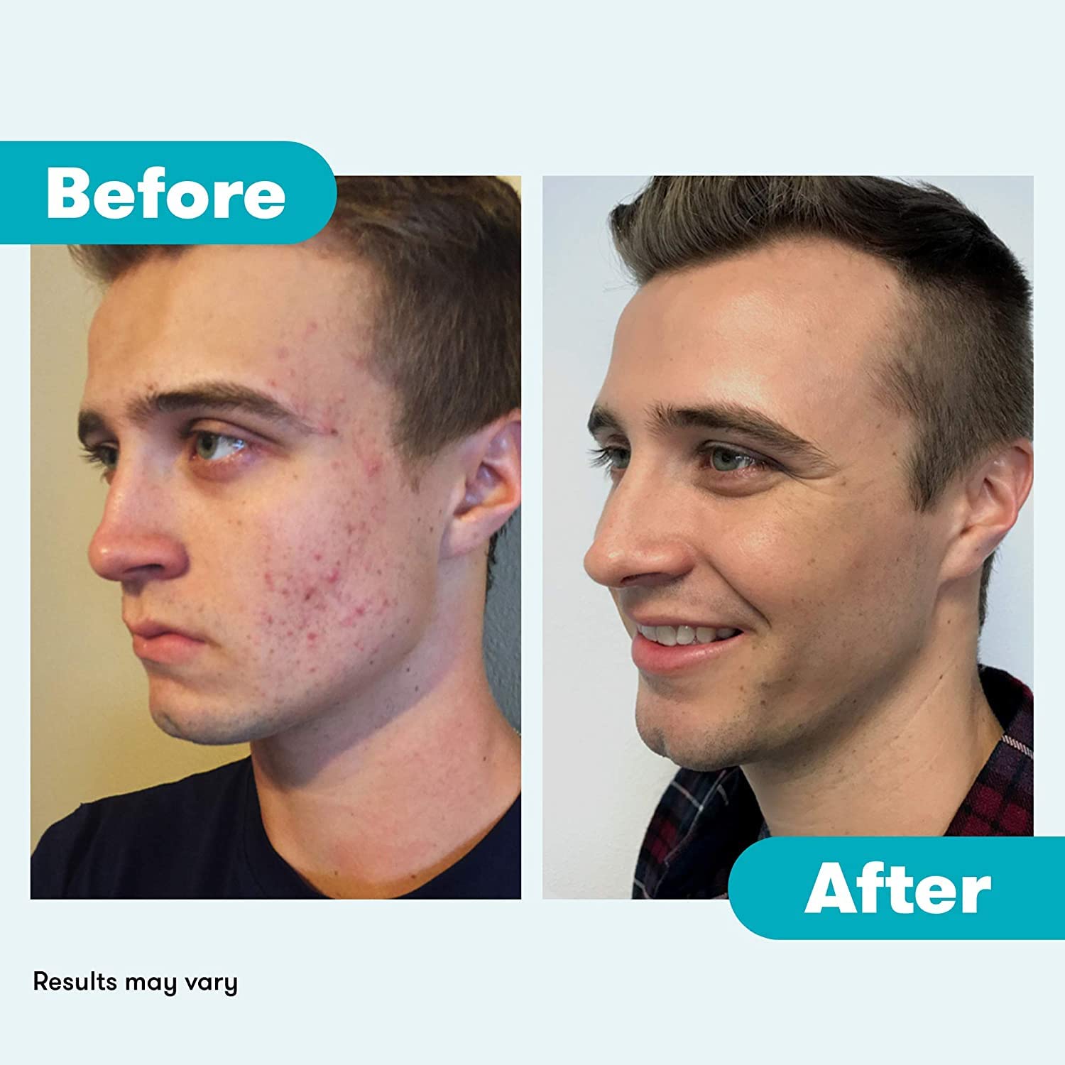 Proactiv Repair brand heritage and trust for acne care.