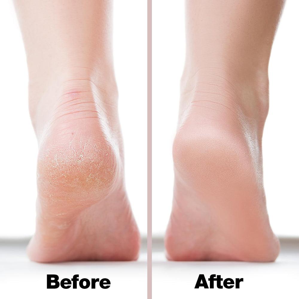 Probelle dry feet setup for a quick pedicure session
