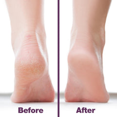 Probelle nickel foot file designed for use on dry feet.