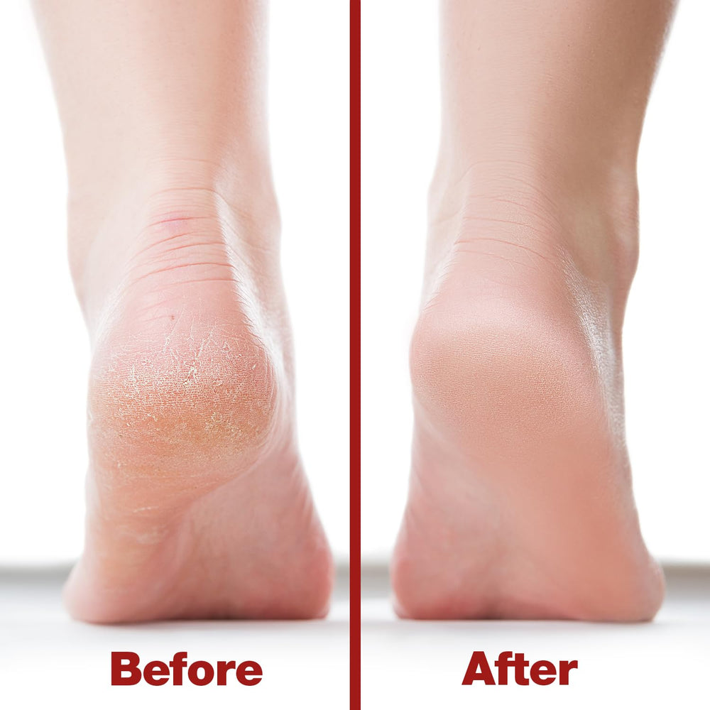 Probelle nickel-file handle provides balanced grip during pedicures.