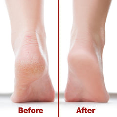 Probelle nickel-file handle provides balanced grip during pedicures.
