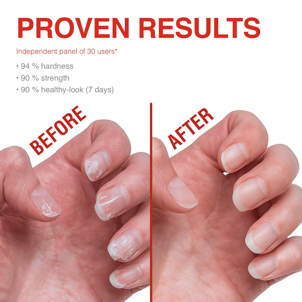 Probelle uñas ingredientes hidratantes hexanal para nutrición rápida.