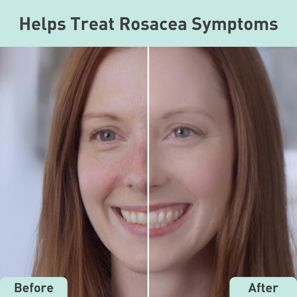 PROcure Rosacare textura suave de mascarilla para mayor comodidad.