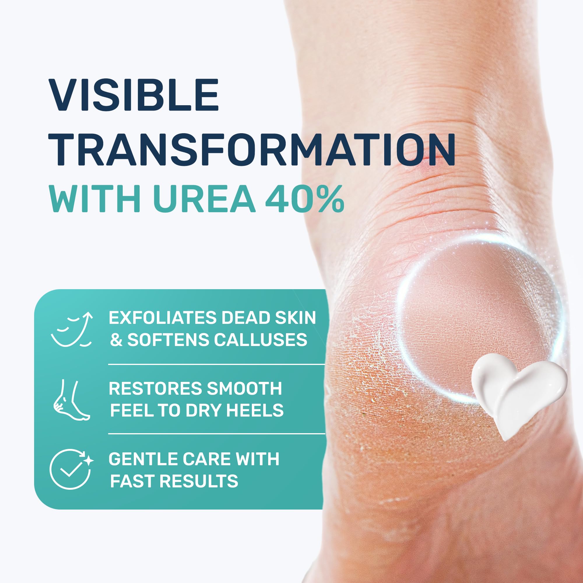 PROJECT 701 exfoliación de pies con urea 40% para suavizar durezas