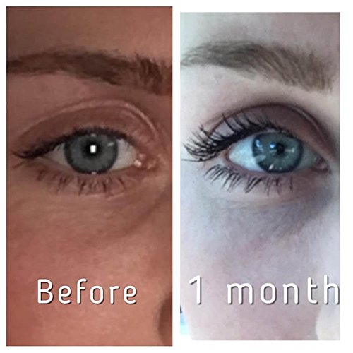 Pronexa Lavish Lash nightly application for simple skincare routine.