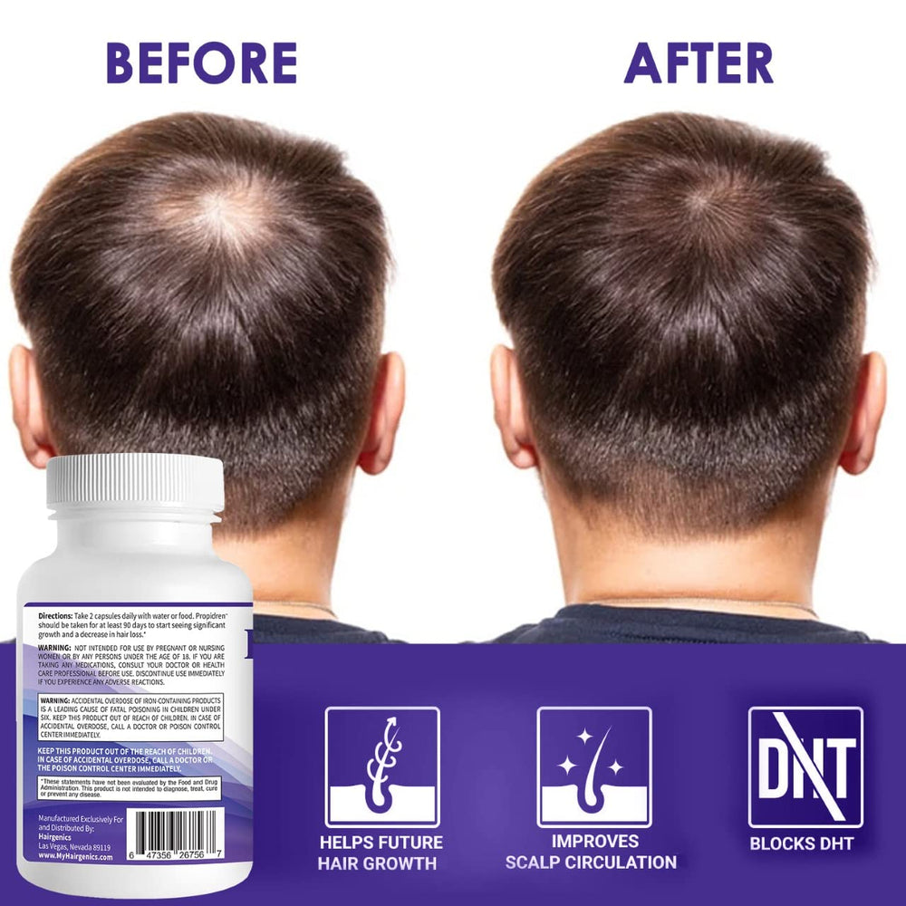 Pronexa Propidren ingredients Green Tea Extract for antioxidant scalp support.