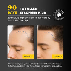Psalmonica Rosemary-Ginger infusion highlights natural scalp care benefits.