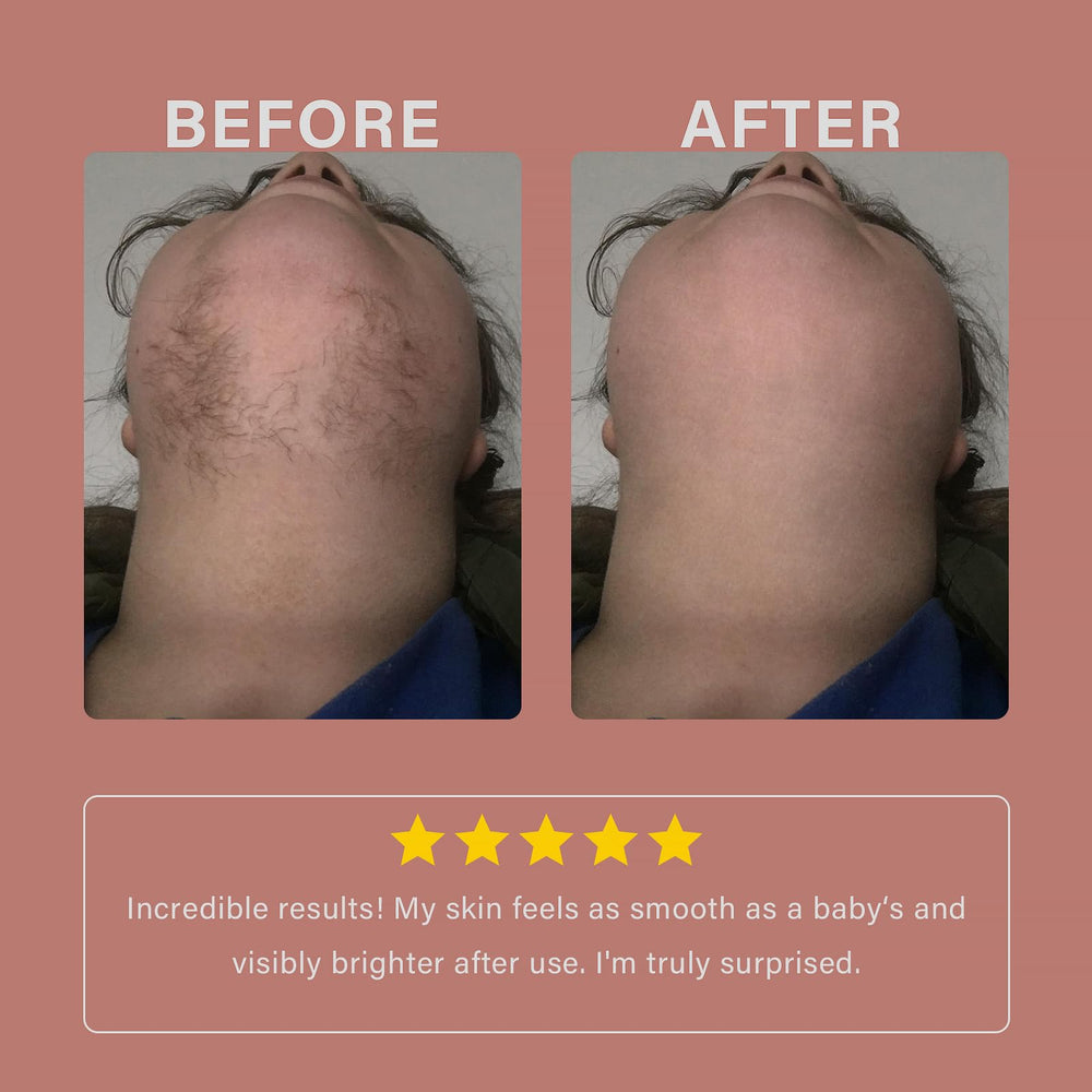 PUILOG makeup-ready skin after removal.