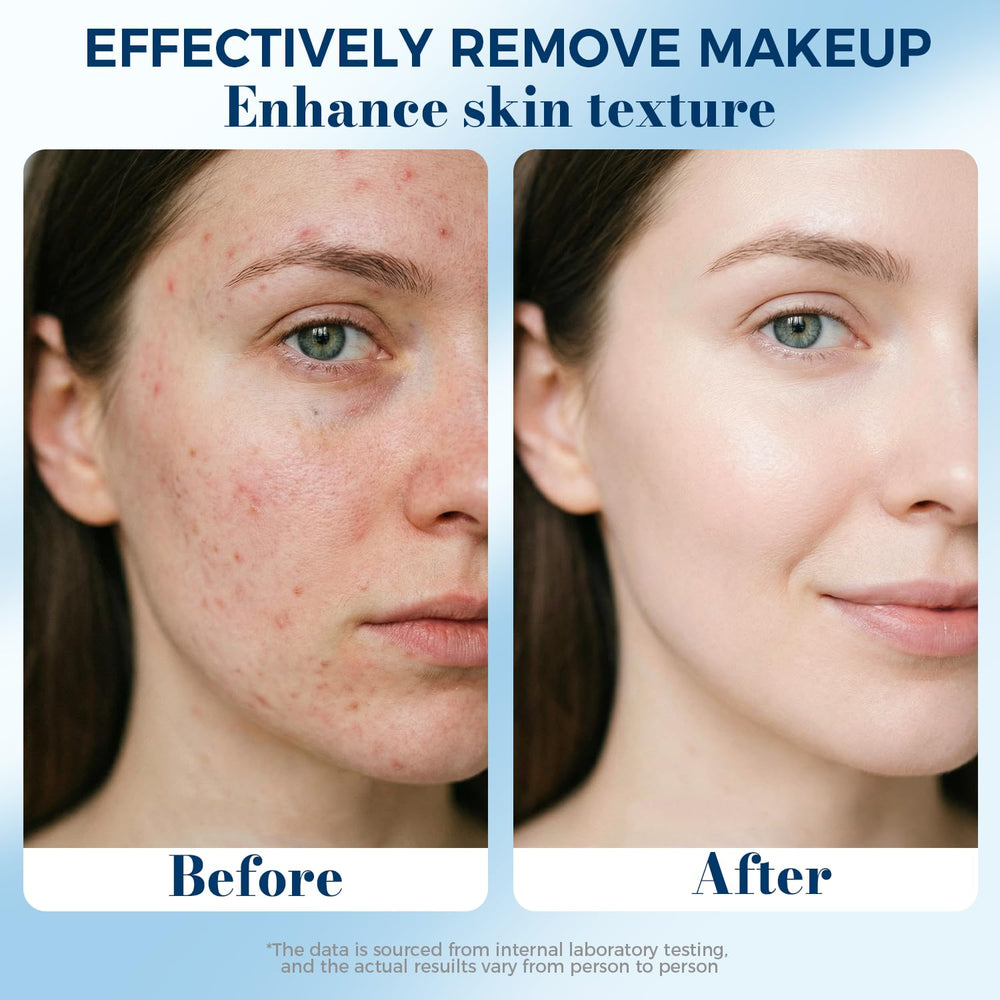 PUPUPE multi-purpose pads for toner, serums, and makeup removal.