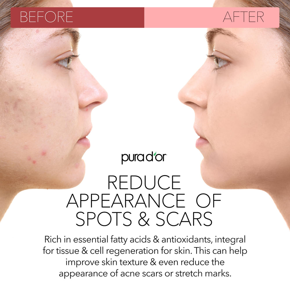 PURA D'OR Antienvejecimiento suave para piel facial