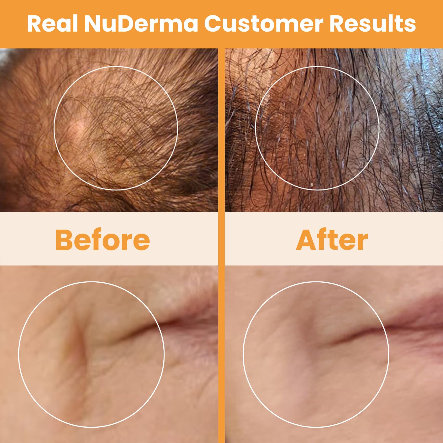 Pure Daily Care NuDerma charging dock closeup for convenient storage