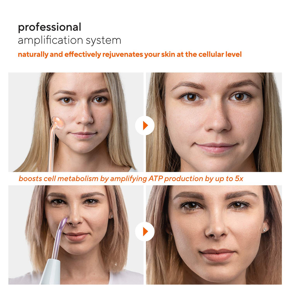 Argon powered rod wand with Tungsten for broader facial areas.
