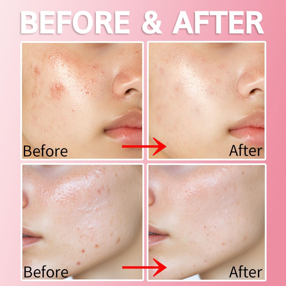 Purederm-aplicacion-dia-noche adecuado para uso continuo con maquillaje.