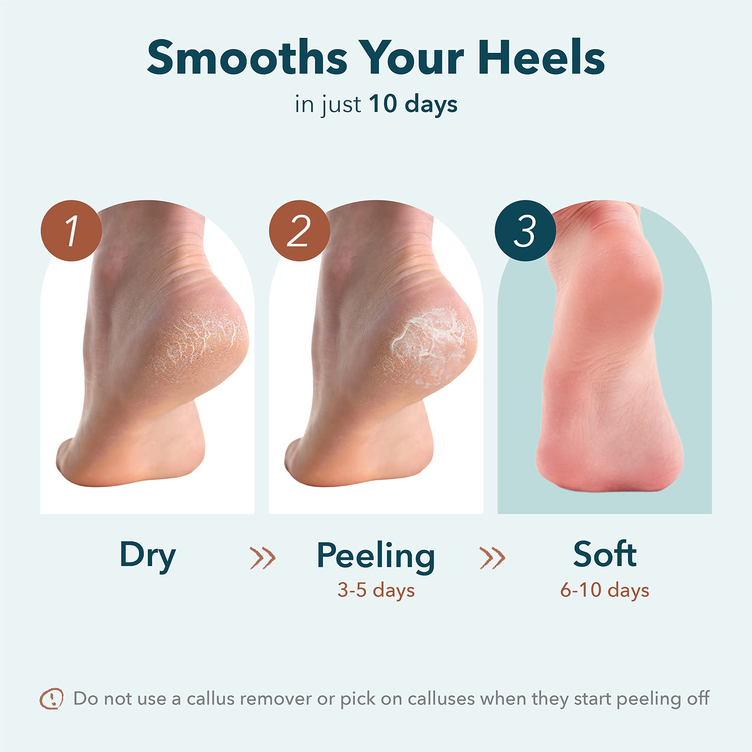 Purederm Heel Mask essence absorption highlights nourishing hydration.