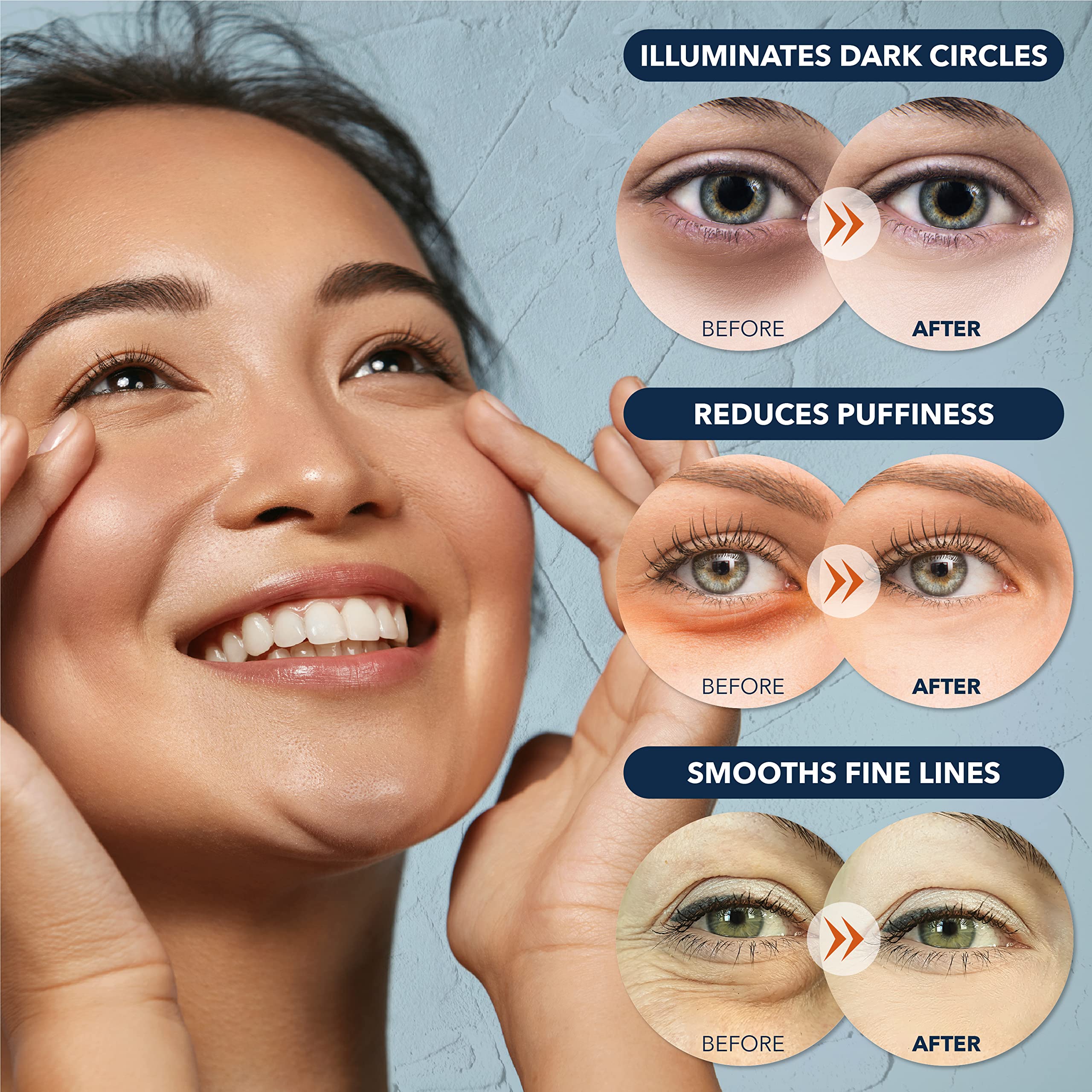 Parches oculares Purederm con colágeno para reducir hinchazón leve.