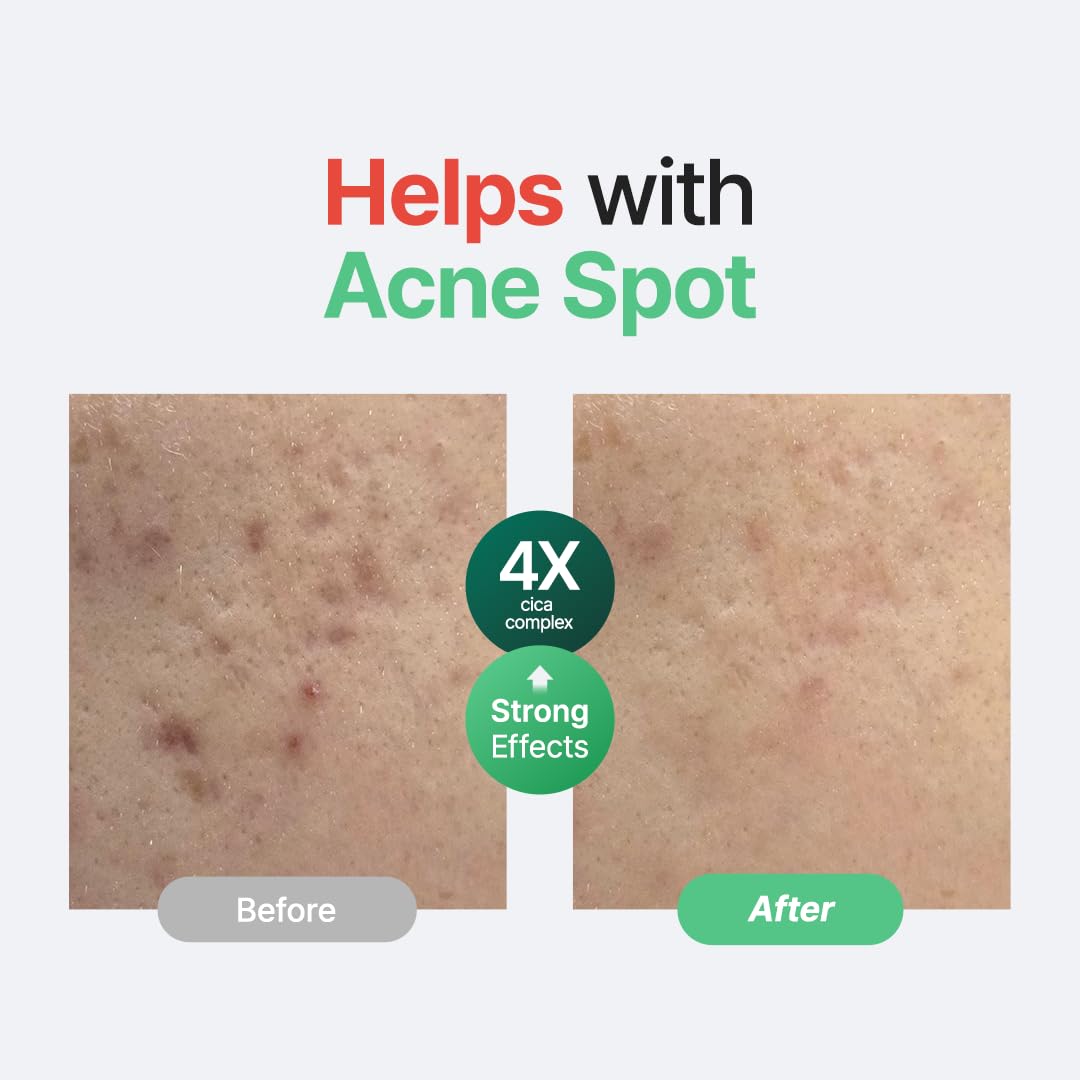 Purito Centella sin fragancia: textura ligera para absorción rápida.