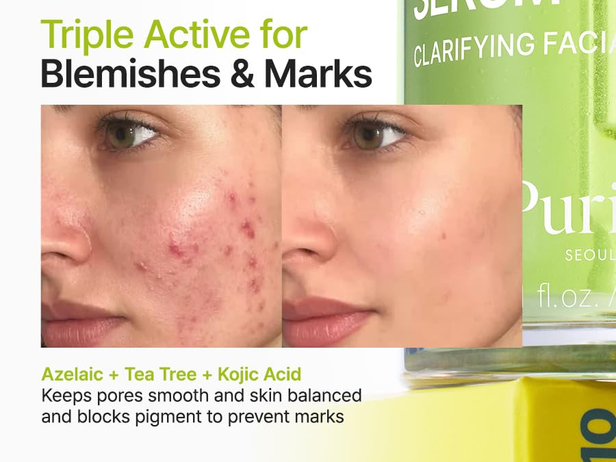 Purito tea tree oil capsules for soothing impurities on skin
