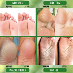 PurOrganica Urea 20% crema: textura cremosa para hidratación diaria.