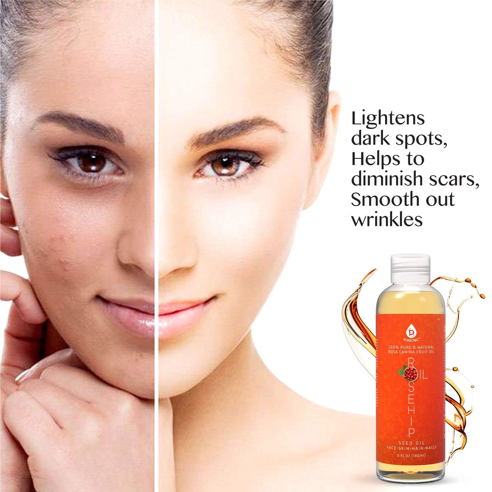 Pursonic Rosehip Oil gift packaging ideal for skincare lovers