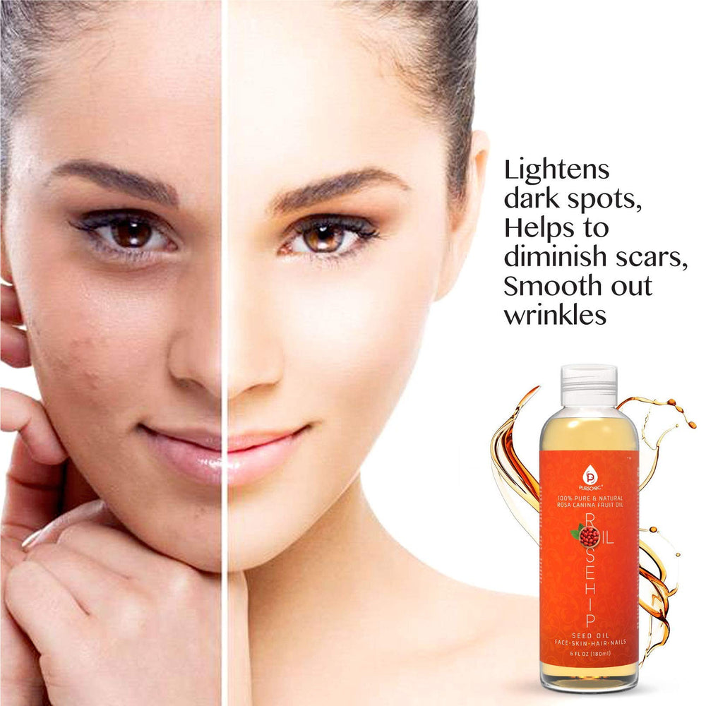 Pursonic Rosehip Oil gift packaging ideal for skincare lovers