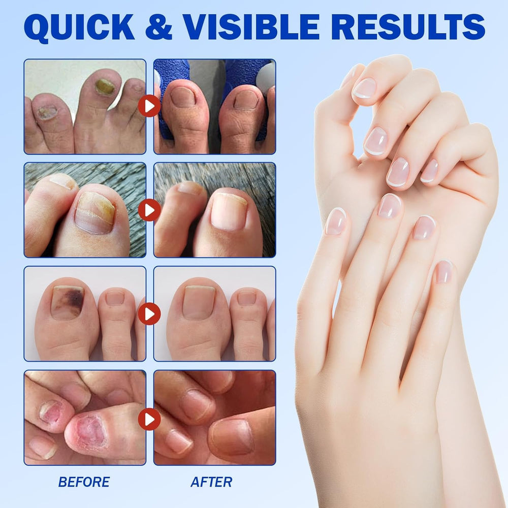 Easy peel-and-stick Pwkvsn patch for quick at-home nail care