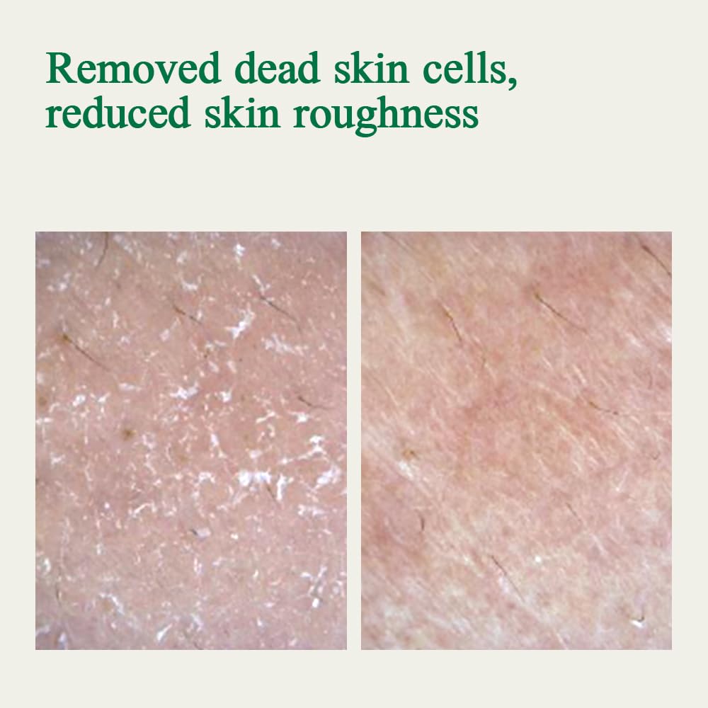 Pyunkang Yul PKY Ultimate Calming ingredients—five types of cica for soothing relief.