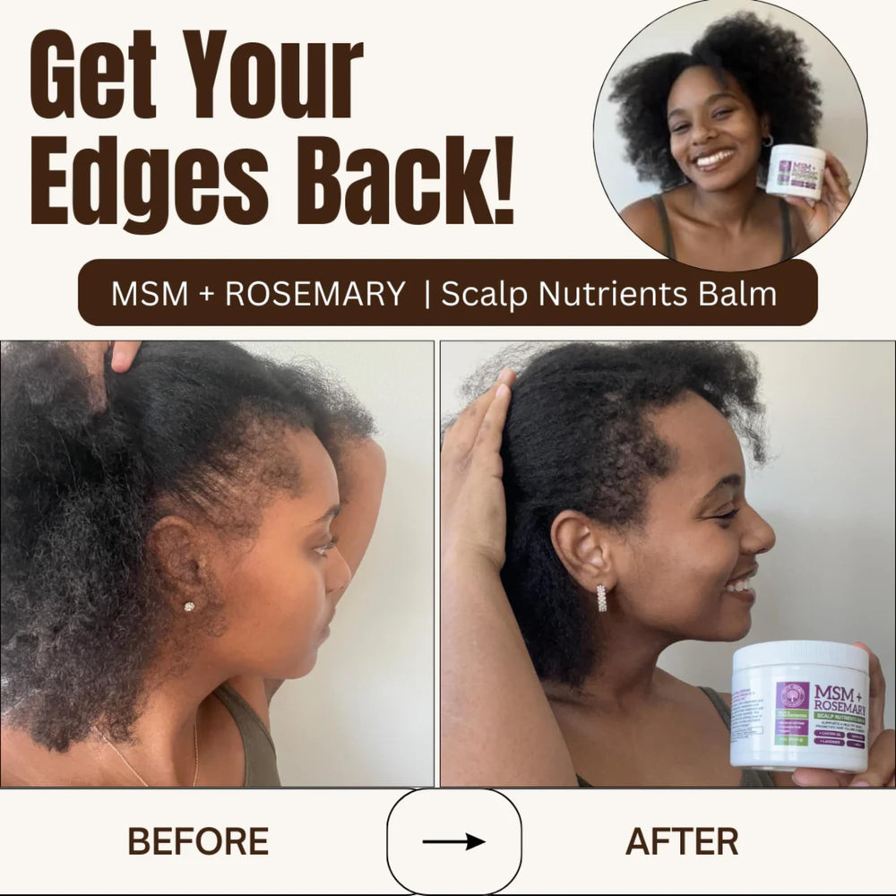Qhemet Biologics Rosemary scent enhances scalp health routine