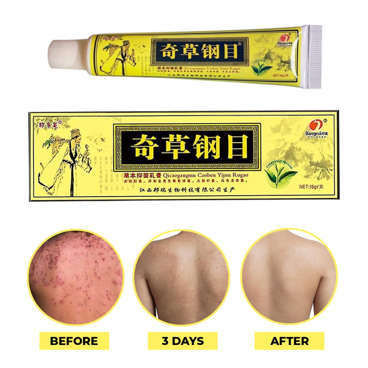 QICAOGANGMU herbal cream jar closeup showing texture for gentle care