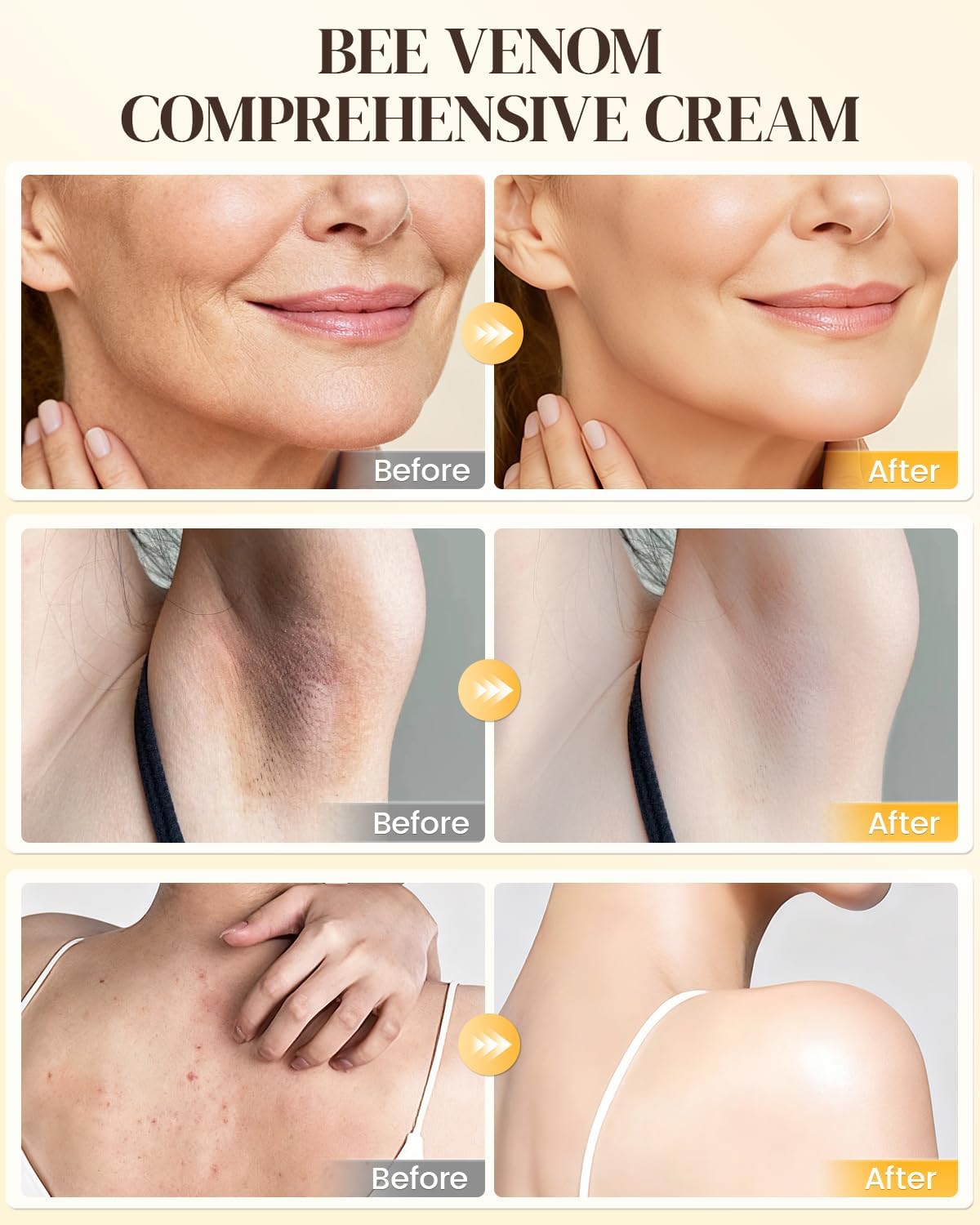 QISARONIX cream on hand demonstrates quick absorption.
