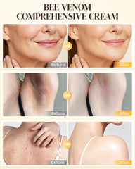 QISARONIX cream on hand demonstrates quick absorption.