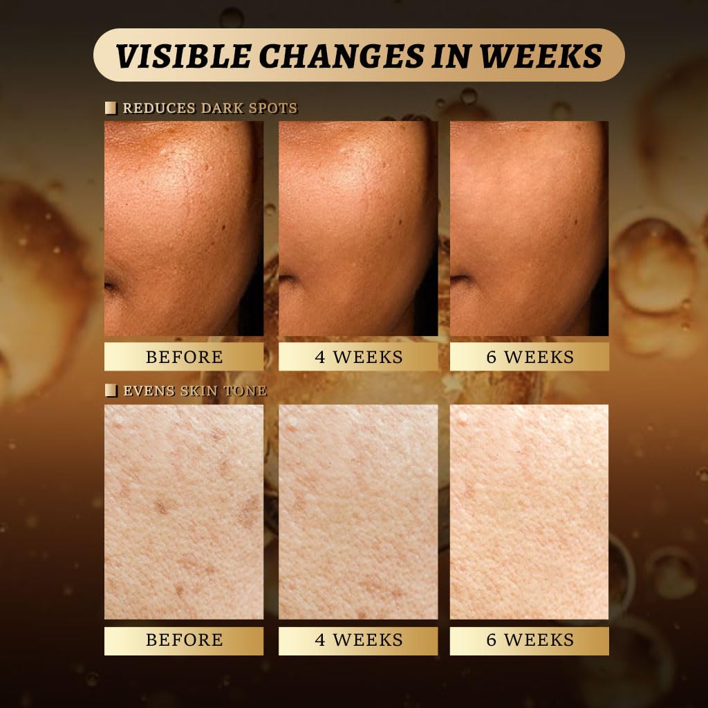 QOOQ deep-pore-cleanse close-up highlights exfoliating action for clearer pores.