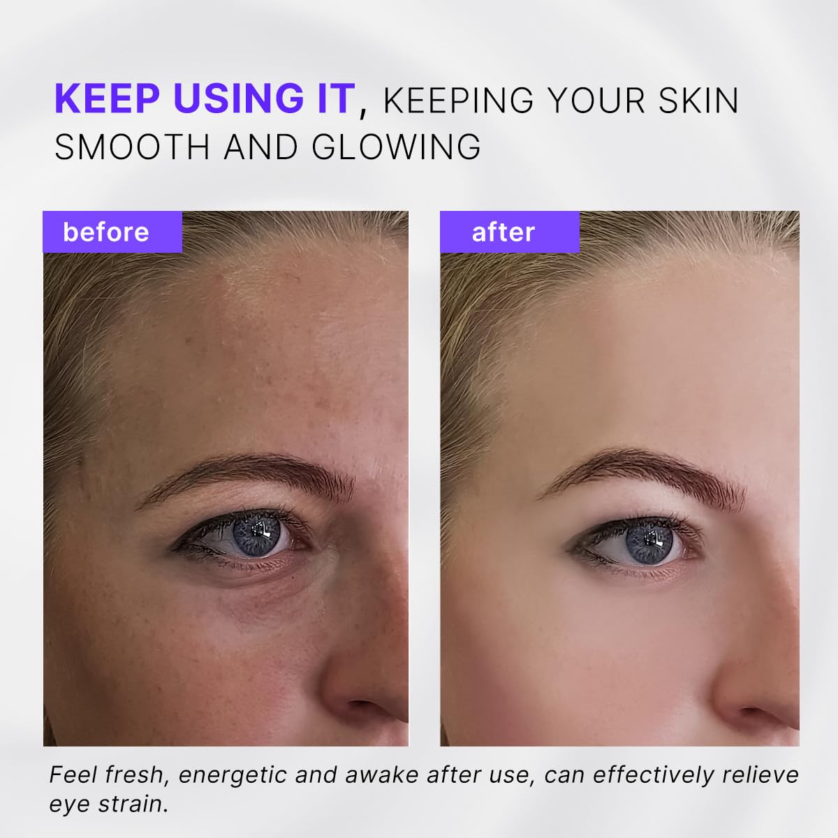 QooWo Eye Roller highlighting the manual acupressure end