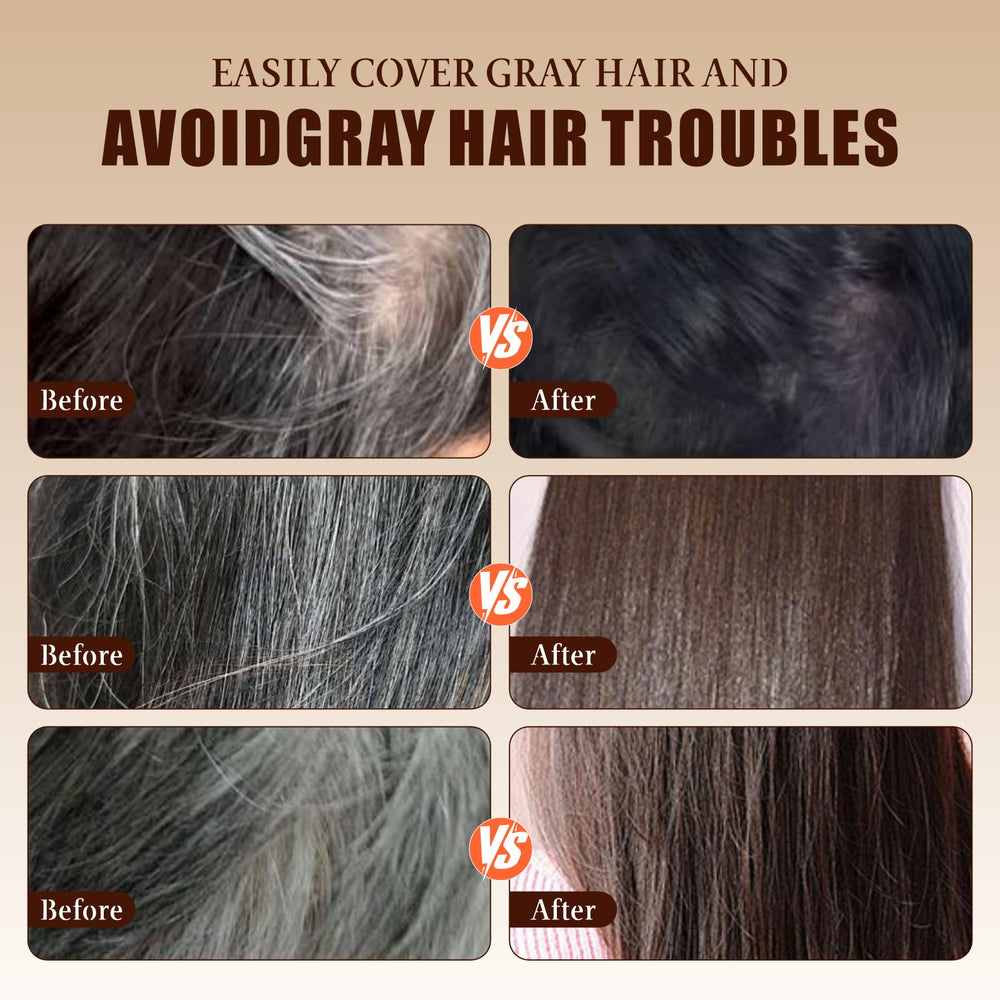Qtaikong temples and roots coverage stick for gray areas