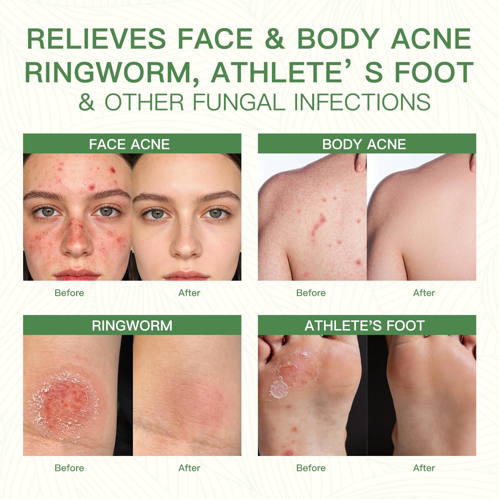 QualiLife aplicación facial, uso suave para piel sensible.