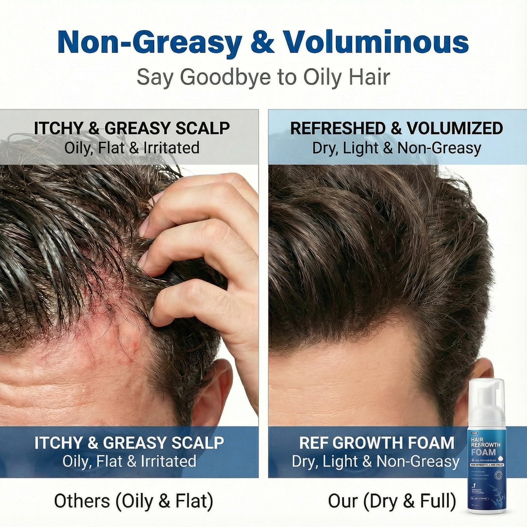 Quilom gentle formula reduces irritation on the scalp.