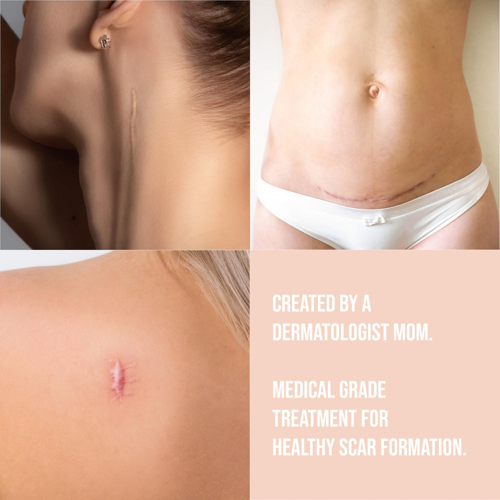 Quitch diseñado por madre dermatóloga, cuidado de la piel con enfoque práctico