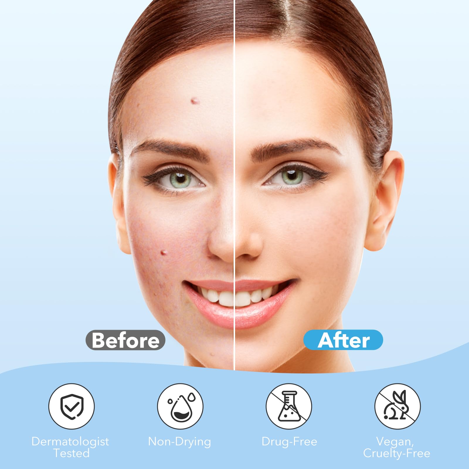 QUSTERE hydrocolloid patch absorbs exudate while protecting the blemish.