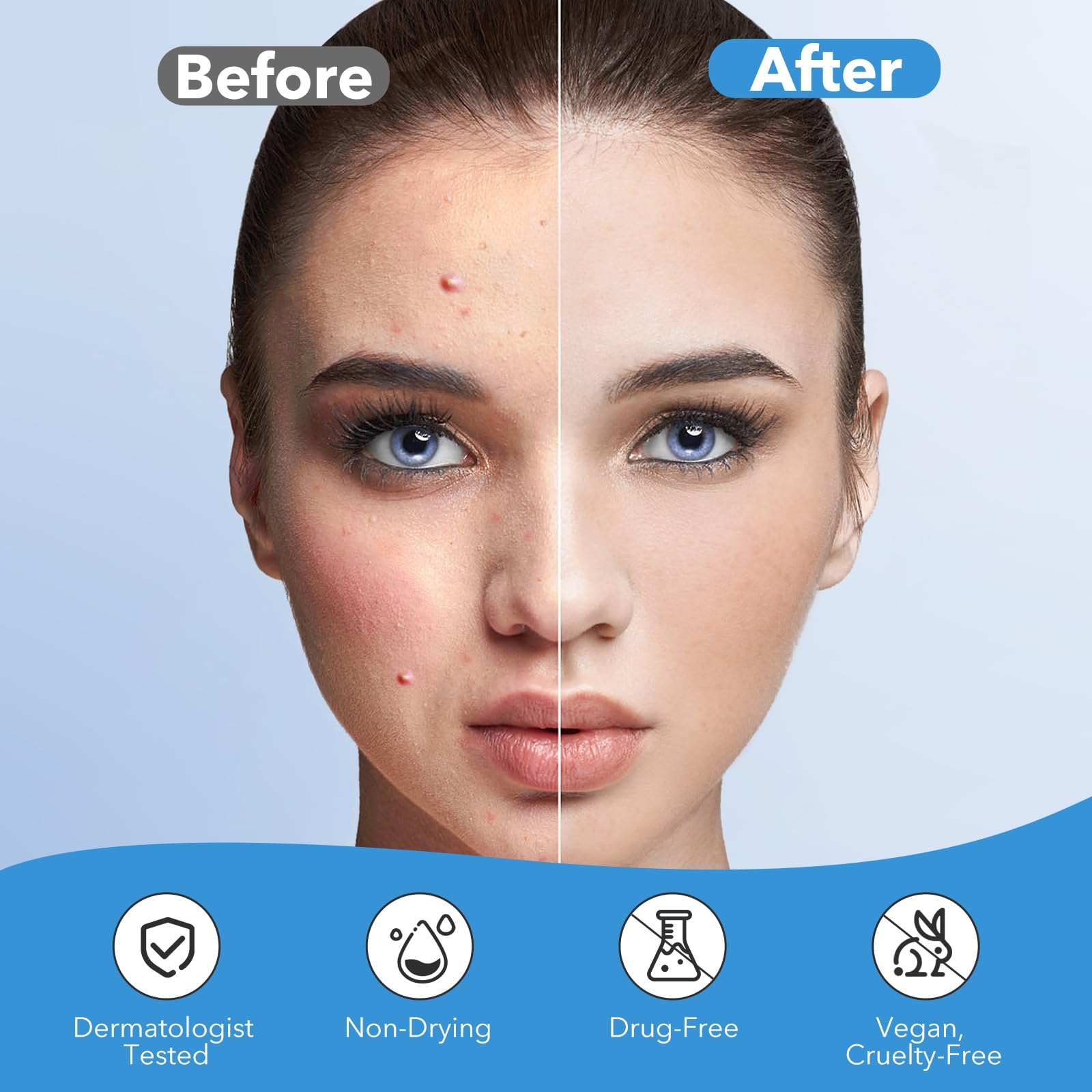 QUSTERE pimple patches light coral color packaging for versatile styling