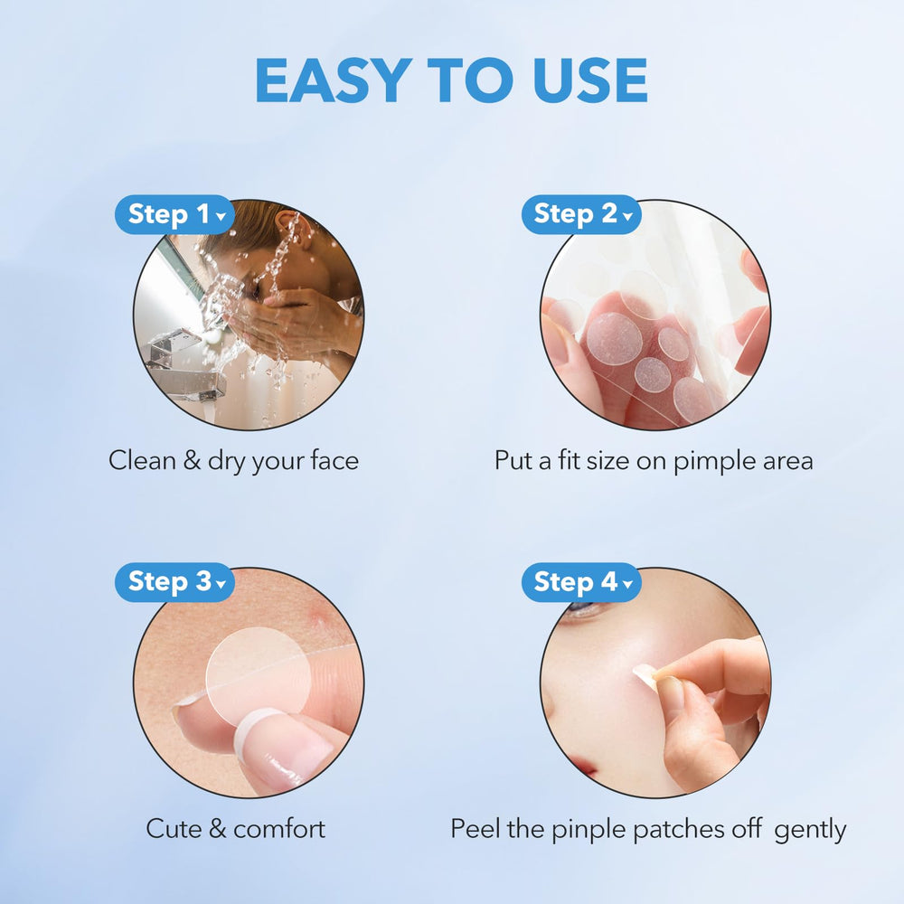 QUSTERE pimple patches five sizes covering various blemish sizes