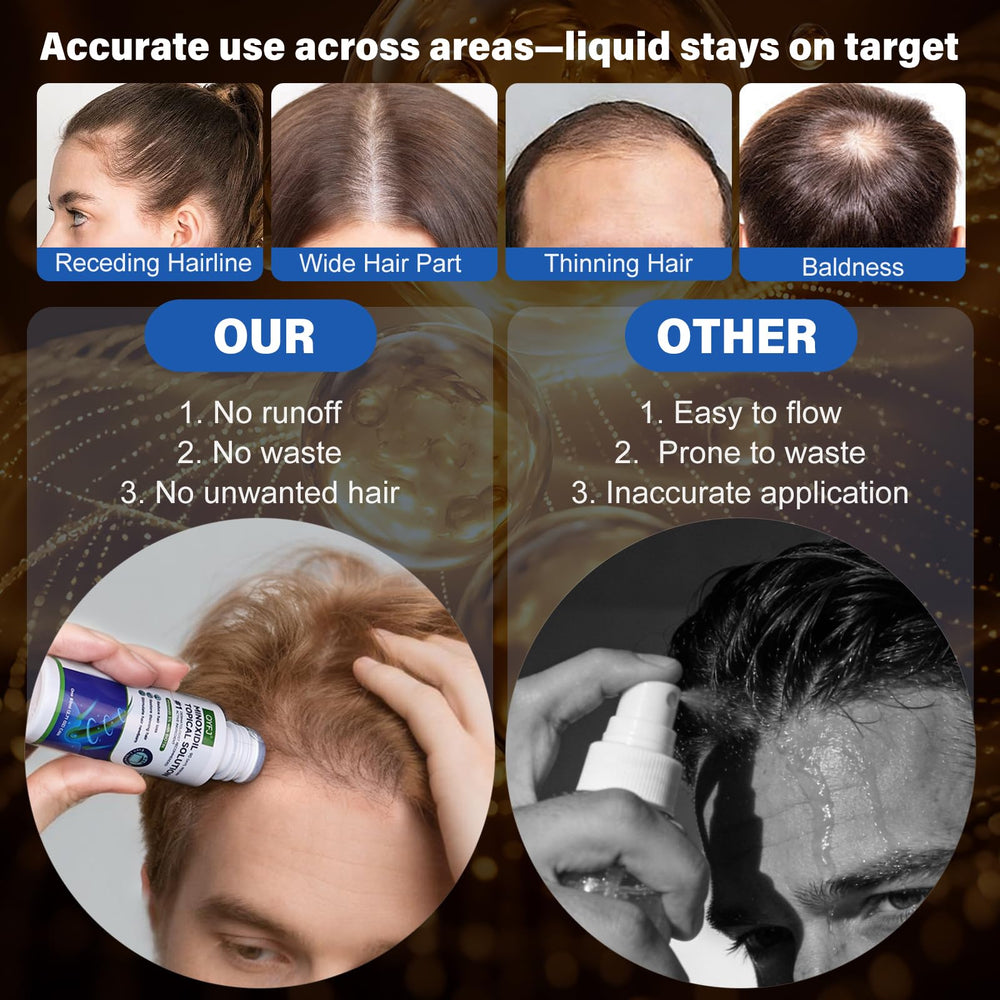 QYFJ biotin-infused minoxidil formula bottle focusing on nourishing follicles.