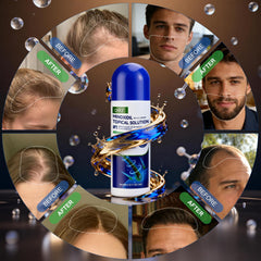 QYFJ minoxidil sponge applicator image highlighting clean, no-drip application.