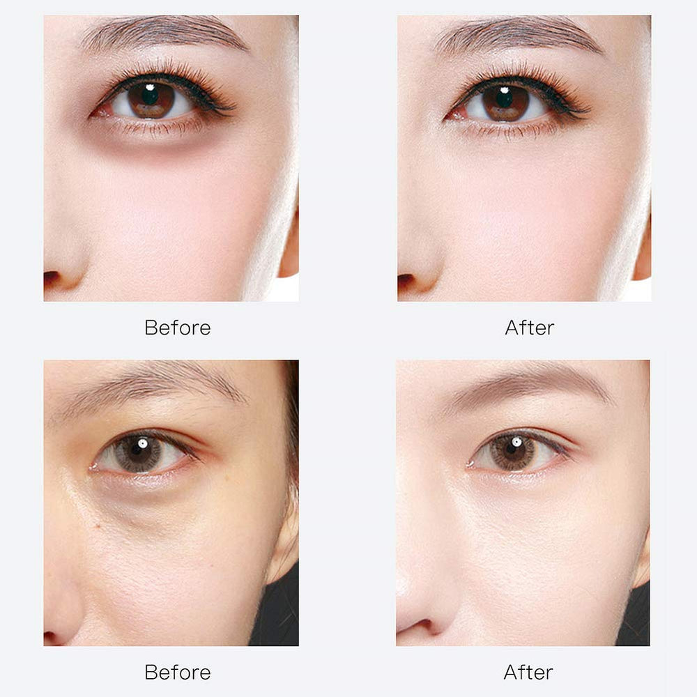 Parches para ojos de RABIOTA: uso suave diurno o nocturno para cuidado facial.