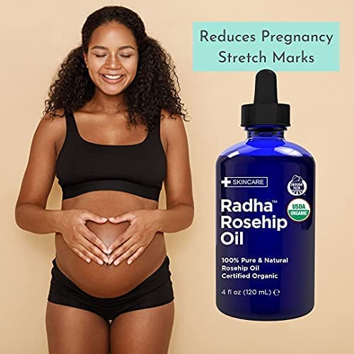 Radha Beauty aceite de rosa mosqueta para uñas y cutículas reforzando